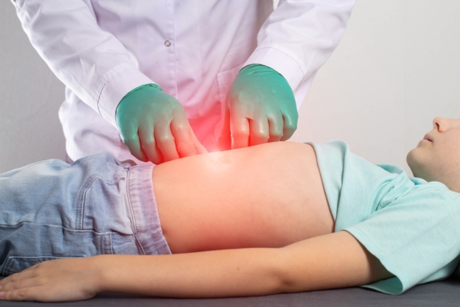 Ομφαλοκήλη